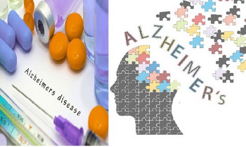 Thuốc mới tiềm năng trong trị bệnh Alzheimer