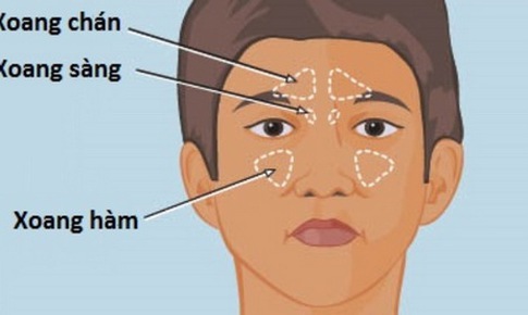 Cảnh gi&#225;c biến chứng nguy hiểm của vi&#234;m xoang