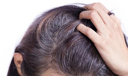 Có thuốc giúp tóc hết bạc?