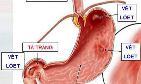 Nhựa c&#226;y - Vị thuốc chữa nhiều bệnh