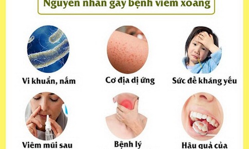 Vi&#234;m mũi xoang dị ứng gia tăng do m&#244;i trường