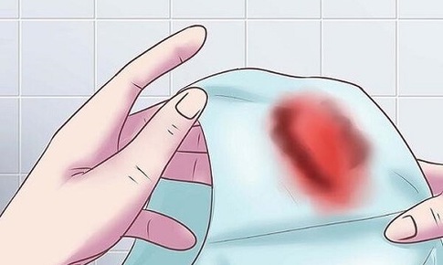 Chảy m&#225;u sau “quan hệ” v&#236; sao?