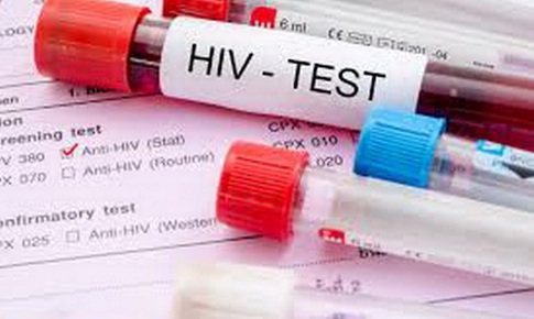 COVID-19 c&#243; thể ảnh hưởng đến mục ti&#234;u to&#224;n cầu ph&#242;ng, chống HIV/AIDS