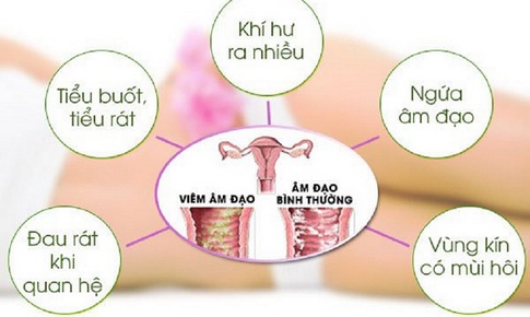 Vi&#234;m nhiễm phụ khoa, khi n&#224;o cần đi kh&#225;m?