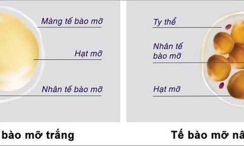 Mỡ trắng, mỡ n&#226;u - hy vọng mới trong điều trị b&#233;o ph&#236;