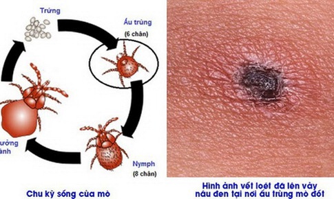 Nguy cơ tử vong do sốt m&#242;