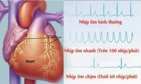 Rủi ro tiềm ẩn khi d&#249;ng thuốc chống rối loạn nhịp tim