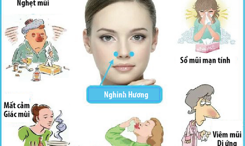 Day ấn huyệt chữa ngạt mũi, chảy nước mũi