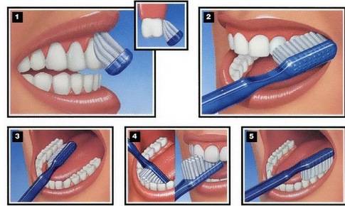 Đối ph&#243; với s&#226;u răng