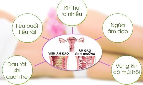 Ngừa vi&#234;m &#226;m đạo ở phụ nữ