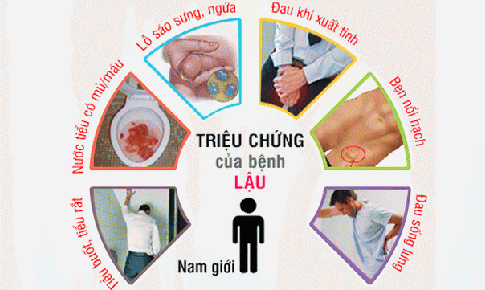 Hệ lụy nguy hiểm của bệnh lậu