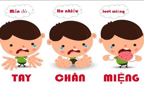 Ngừa biến chứng bệnh tay ch&#226;n miệng