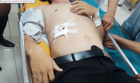Bị nhắc nhở hình xăm trên cổ, học trò đâm thầy giáo thấu bụng