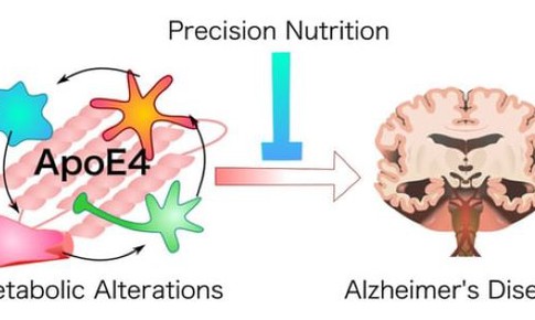 Mục ti&#234;u điều trị mới tiềm năng cho bệnh Alzheimer  &#160;