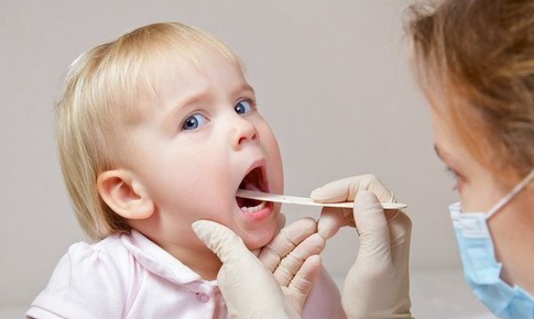Trẻ bị viêm họng cấp nên hay không nên uống kháng sinh?