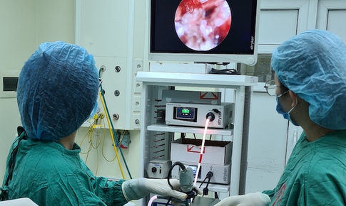 "Sỏi" trong mũi - Hãy cảnh giác