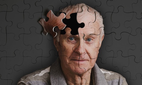 Lưu &#253; khi chăm s&#243;c người mắc bệnh Alzheimer