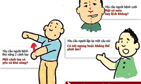 C&#225;ch ph&#225;t hiện sớm đột quỵ