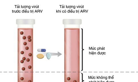 Th&#244;ng điệp”K=K”: “Kh&#244;ng ph&#225;t hiện = Kh&#244;ng l&#226;y truyền” vir&#250;t HIV