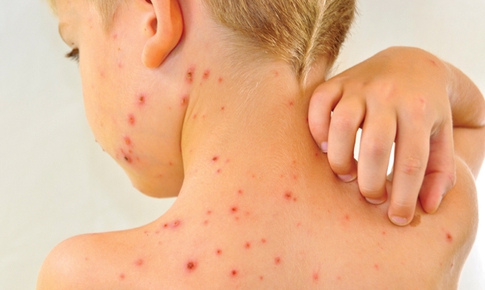 Tai hại tự điều trị cho trẻ bằng phương pháp truyền miệng