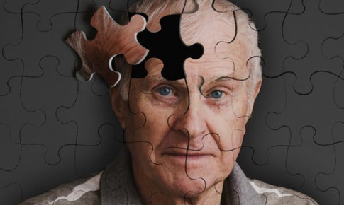 X&#225;c định biến thể gene g&#226;y bệnh Alzheimer