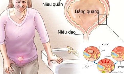 Nhận biết, xử tr&#237; nhiễm tr&#249;ng tiết niệu ở người cao tuổi