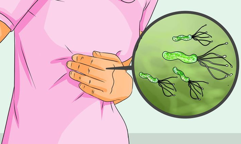 D&#249;ng thuốc đ&#250;ng c&#225;ch trị vi&#234;m lo&#233;t dạ d&#224;y do H.pylori