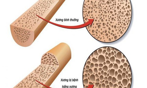 Cách dùng xương ngựa làm thuốc
