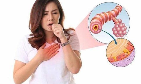 B&#224;i thuốc trị vi&#234;m đường h&#244; hấp cấp&#160;