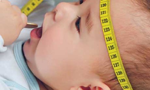 Phương pháp mới chữa não úng thủy: Cơ hội cho những đứa trẻ “đầu to”