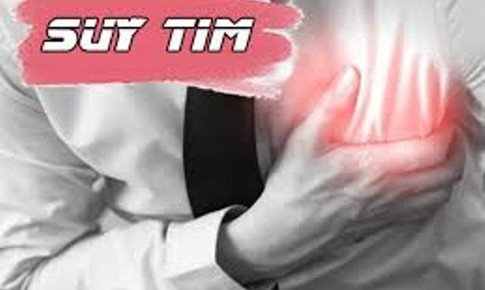 Mới: Bộ Y tế hướng dẫn chẩn đo&#225;n v&#224; điều trị suy tim mạn t&#237;nh