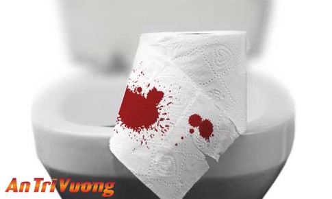 Đi cầu ra m&#225;u l&#224; bệnh g&#236;?