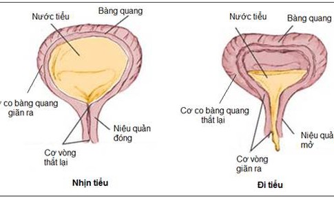 Trị dứt điểm bệnh đ&#225;i dầm v&#224; đ&#225;i kh&#244;ng tự chủ từ thi&#234;n nhi&#234;n