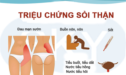 Sỏi thận v&#224; biện ph&#225;p ngăn ngừa sỏi từ thảo dược