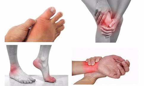 Loại bỏ viêm khớp dạng thấp hiệu quả cao bằng Đông y