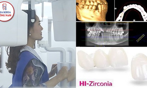 Trồng răng sứ với c&#244;ng nghệ CT 3D Conebeam v&#224; HI-Zirconia