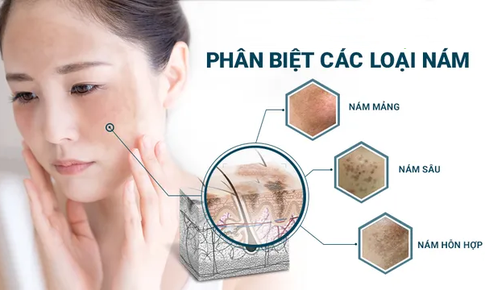 Những &#39;vương dược&#39; d&#224;nh cho chị em l&#224;m s&#225;ng, đẹp da