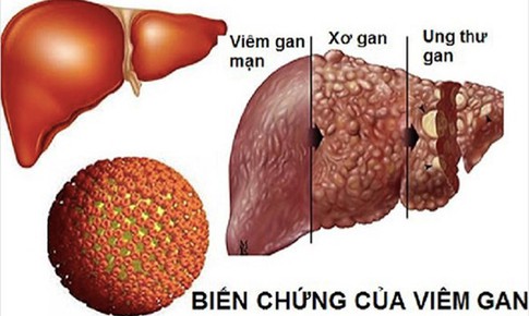 “0” đồng để kiểm tra c&#225;c bệnh l&#253; về m&#225;u, men gan với 3.000 người d&#226;n