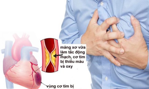 X&#233;t nghiệm định kỳ tại nh&#224; - b&#237; quyết gi&#250;p bạn sống khỏe với bệnh mạn t&#237;nh