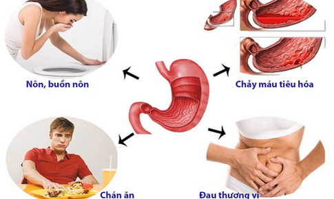 Bệnh đau dạ d&#224;y v&#224; những triệu chứng điển h&#236;nh