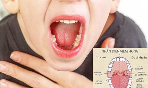 C&#225;ch bảo vệ họng cho trẻ, tr&#225;nh nhiễm bệnh