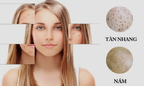 Collagen thuỷ ph&#226;n – Xu hướng l&#224;m đẹp mới