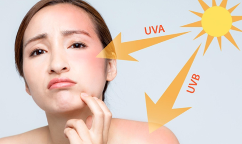 B&#237; k&#237;p đơn giản gi&#250;p da chống nắng hiệu quả ng&#224;y h&#232;