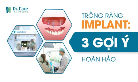 3 gợi &#253; quan trọng cho người trung ni&#234;n khi chọn nha khoa trồng răng Implant