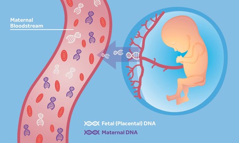 NIPT - C&#244;ng nghệ mới gi&#250;p s&#224;ng lọc di truyền trước sinh