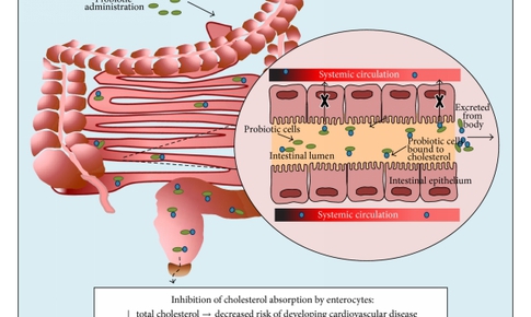 Lactobacillus plantarum hỗ trợ giảm mỡ m&#225;u, giảm nguy cơ xơ vữa động mạch