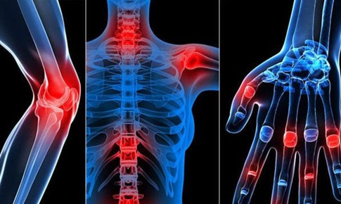 Học viện Quân y sản xuất thảo dược hỗ trợ khắc phục bệnh xương khớp lâu năm