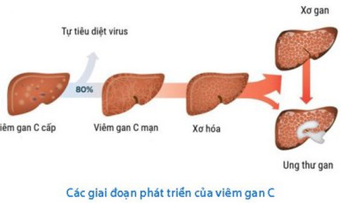 Mở rộng thuốc trị vi&#234;m gan C của người lớn cho trẻ em