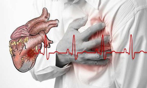 Một số dấu hiệu cảnh b&#225;o ngừng tim bạn cần biết