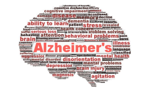 T&#237;ch lũy mảng b&#225;m Amyloid xuất hiện trước khi c&#243; triệu chứng của bệnh Alzheimer